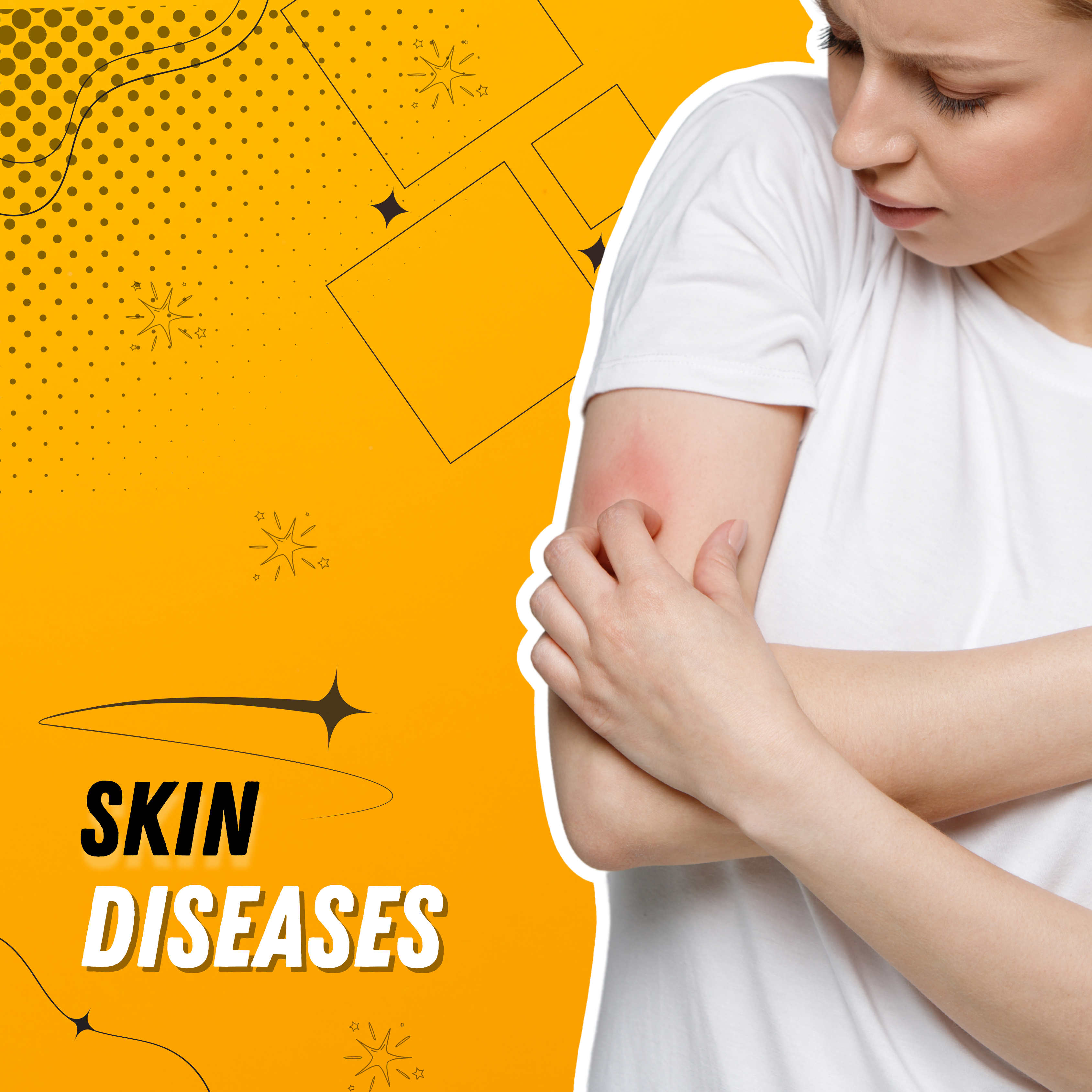 Ayurvedic Treatment for Skin Diseases in Kerala